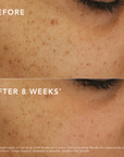 C-Bright Dark Spot Corrector